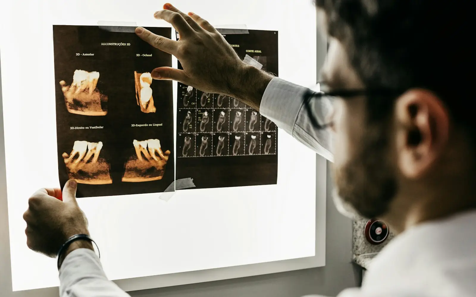 Dentist examining a dental X-ray